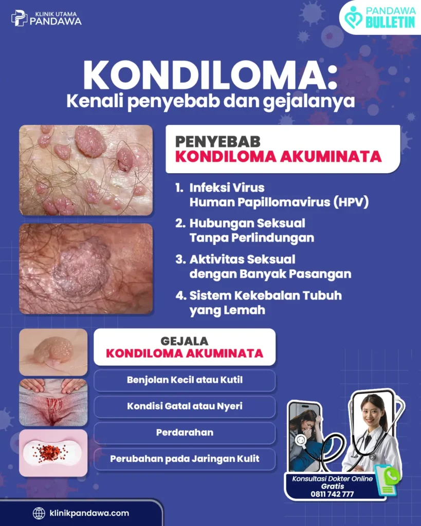 Infografis Kondiloma Akuminata - Klinik Pandawa