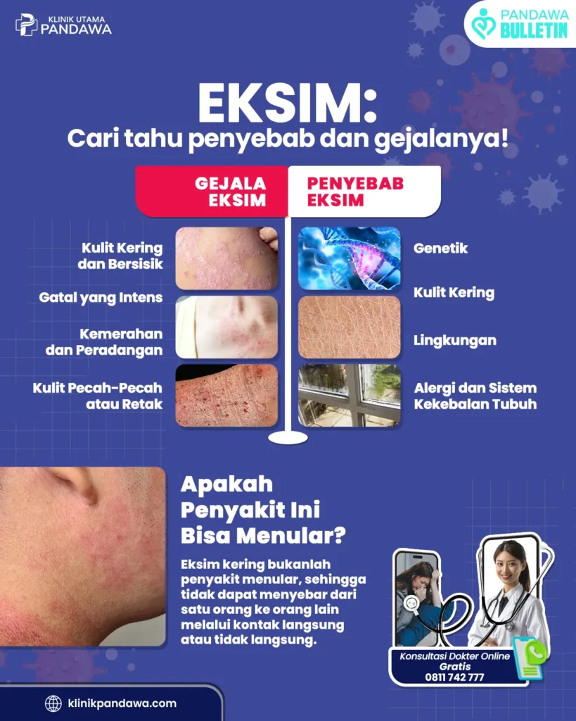 Infografis eksim - klinik pandawa