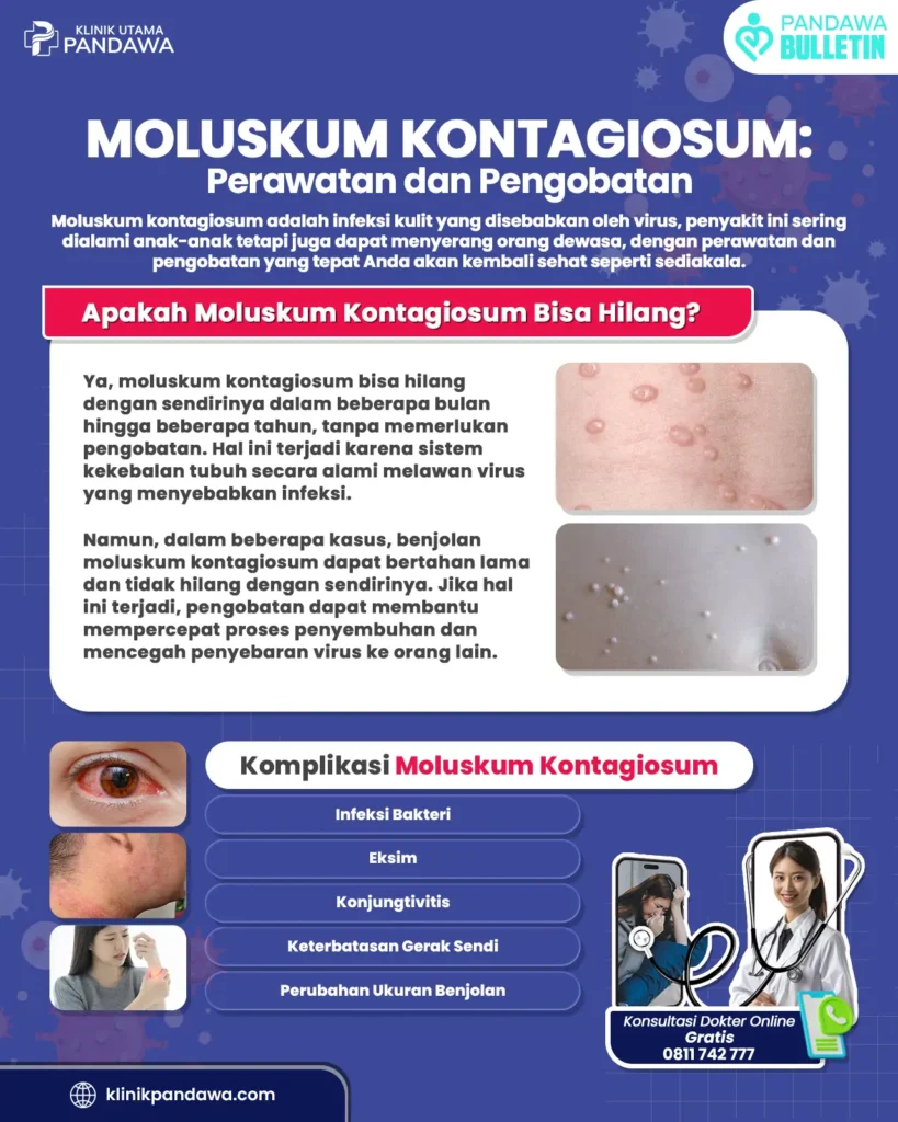 Infografis moluskum - klinik pandawa