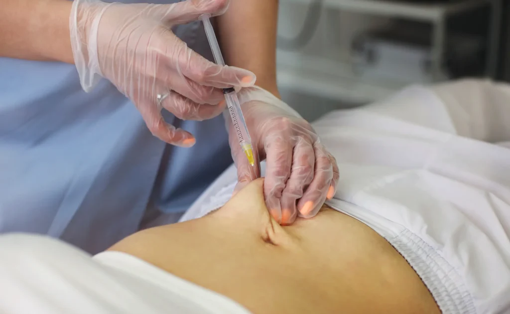 prosedur lipolysis injection