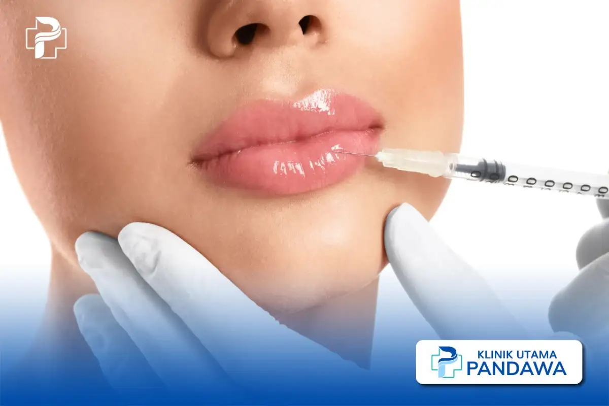 Filler Bibir Before After