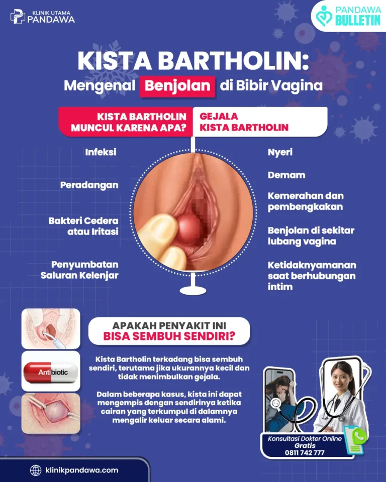 Infografis kista bartholin klinik pandawa