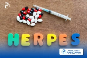 penyembuhan herpes genital