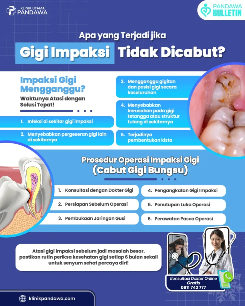 Infografis gigi impaksi klinik utama pandawa