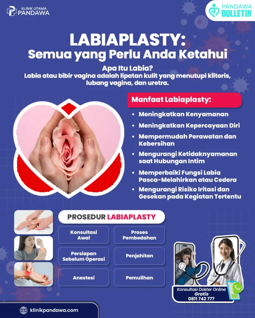 Infografis labiaplasty - Klinik utama pandawa