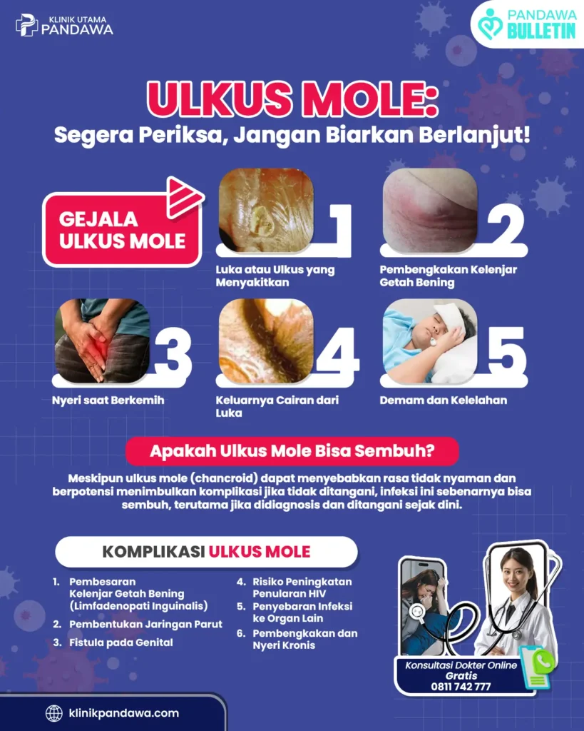 Infografis ulkus mole - Klinik Pandawa