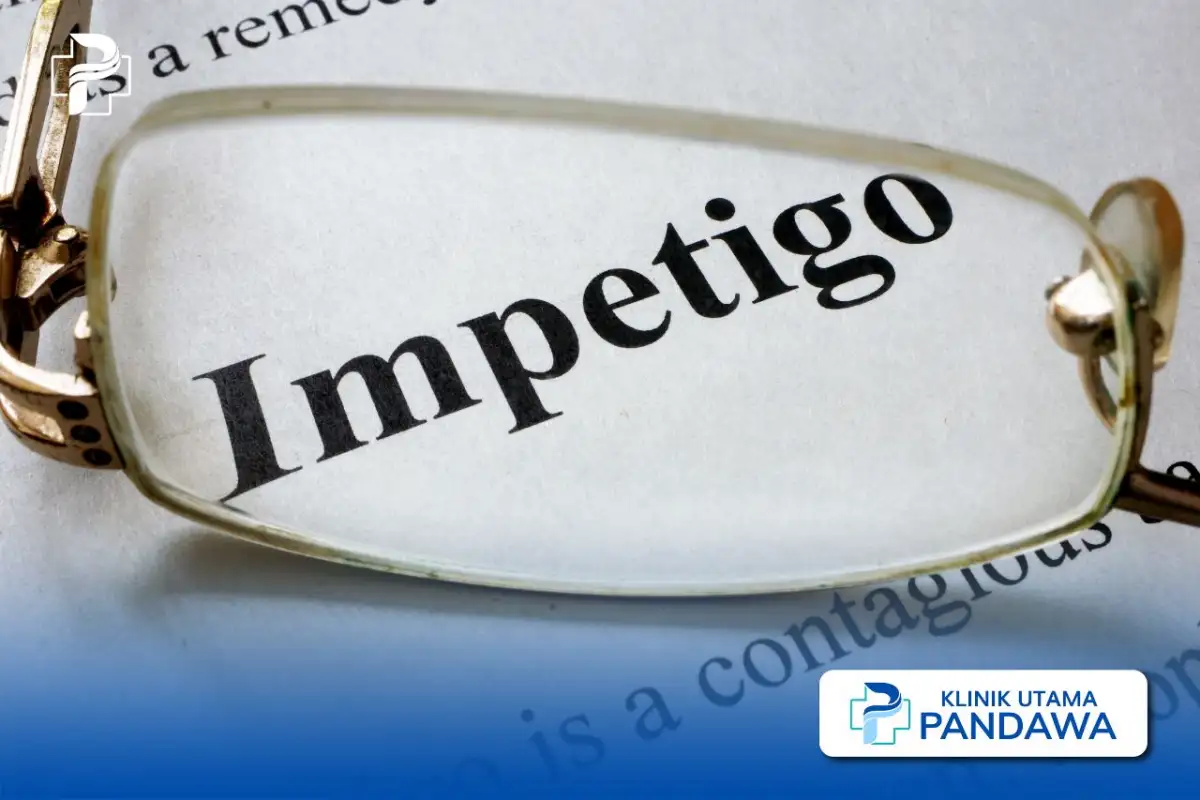 pengobatan impetigo