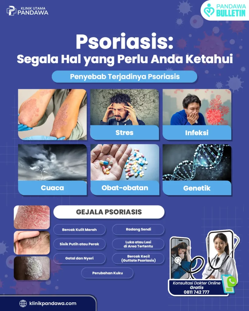 Infografis psoriasis - klinik pandawa