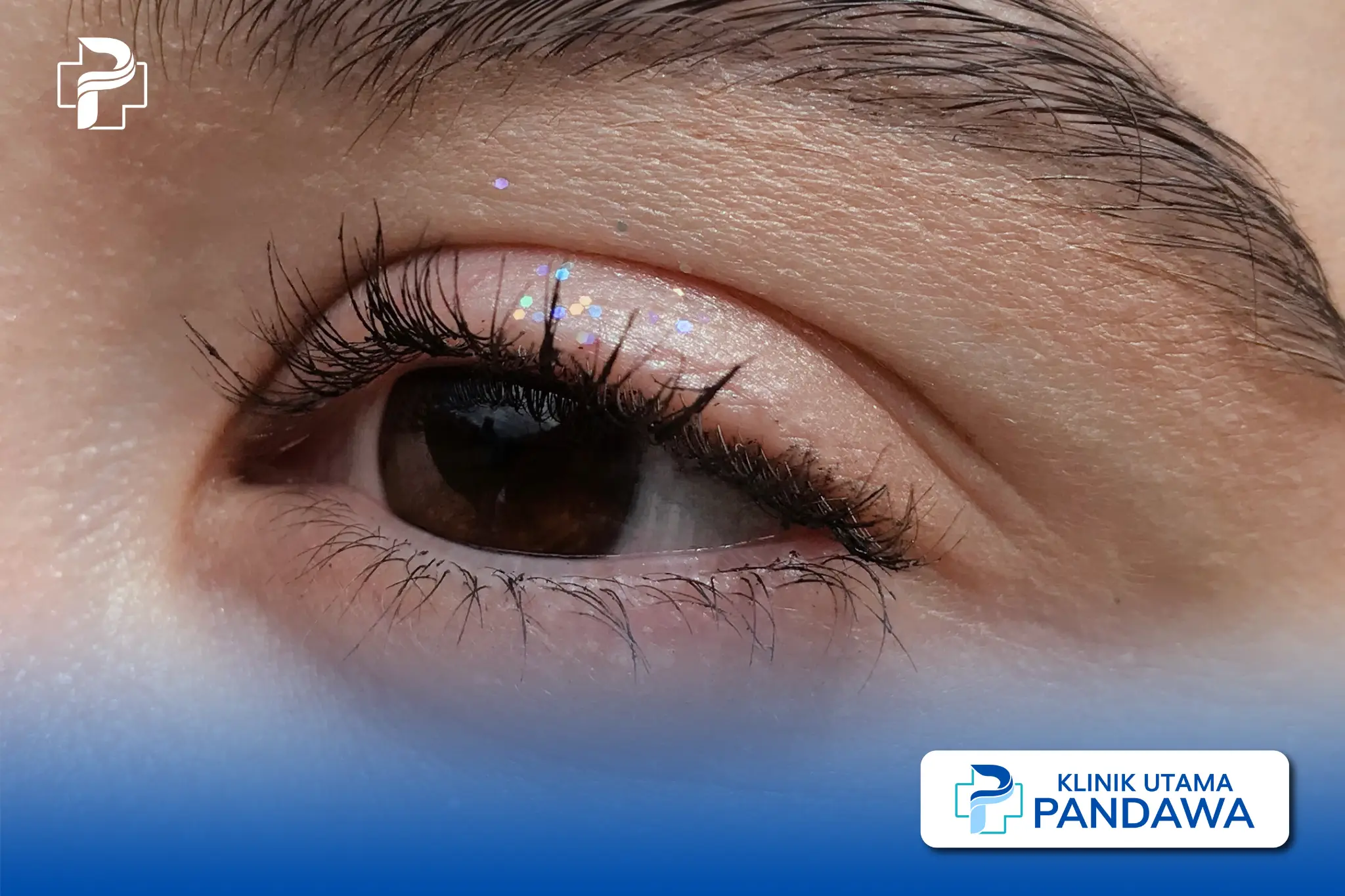 eyelid surgery