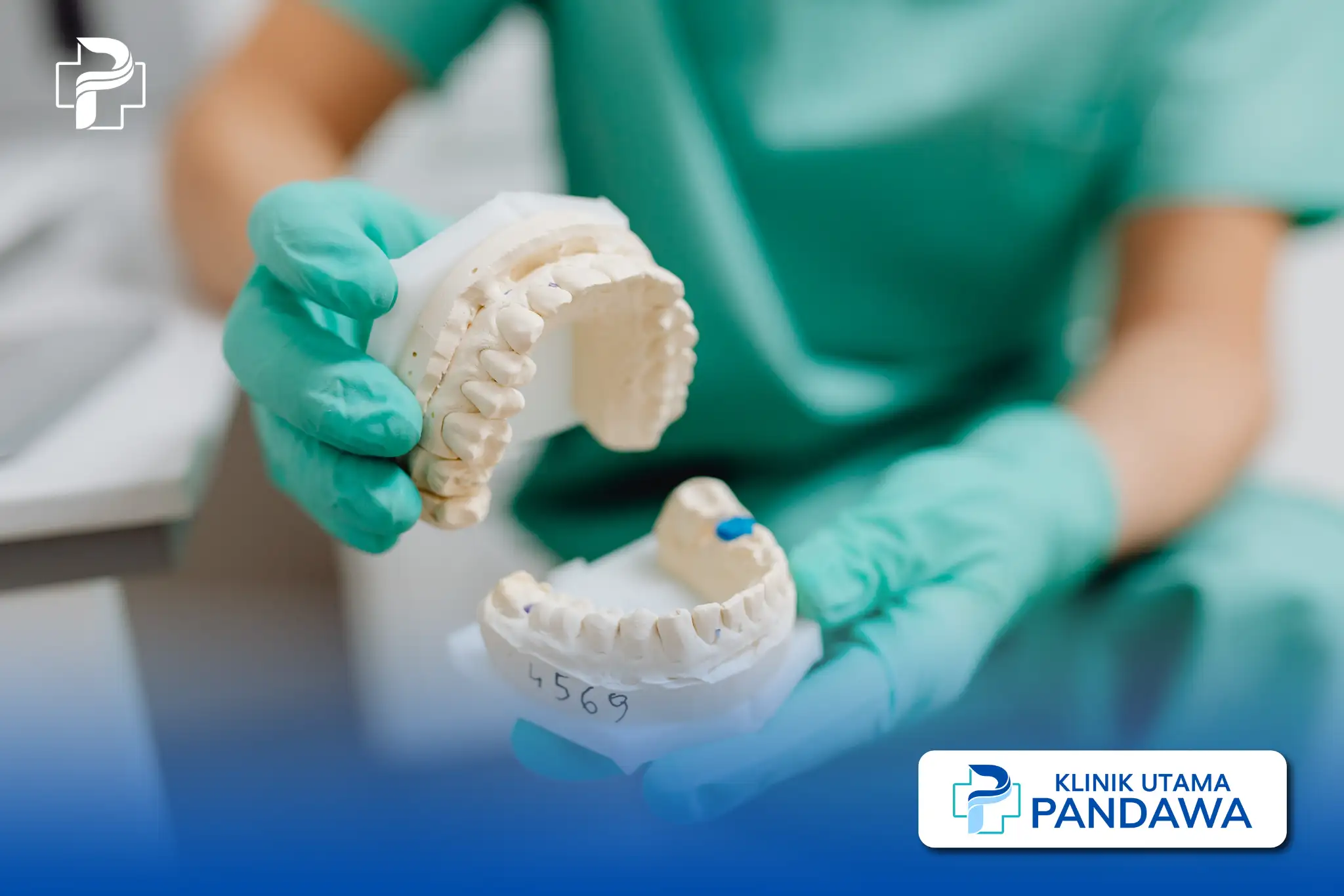 dental bridge