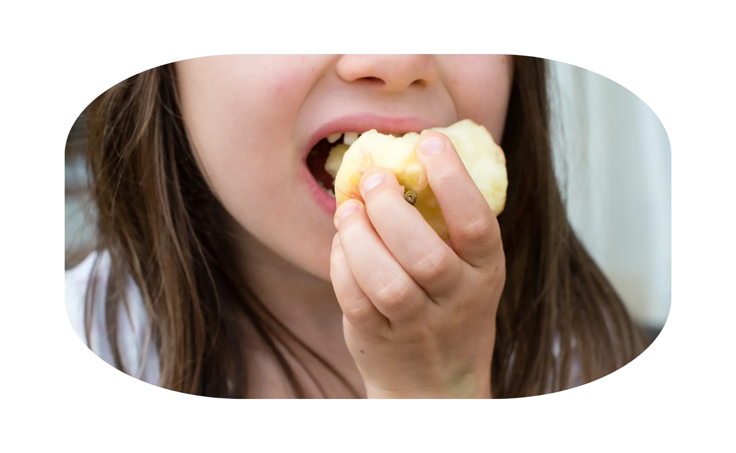 indikasi pasang behel gigi 1